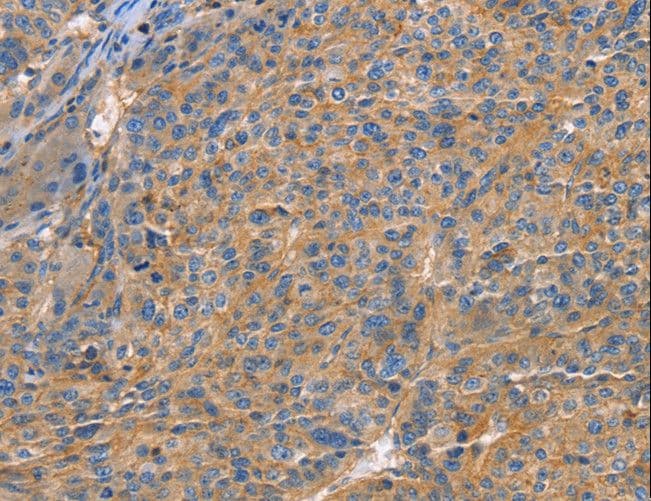 GNB1 Antibody