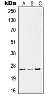 KLK11 / Kallikrein 11 Antibody (Internal)