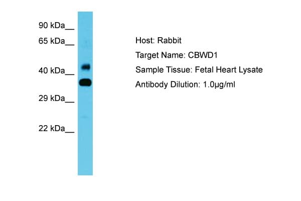 CBWD1 Antibody (aa108-157)