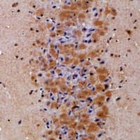 PREP / Prolyl Endopeptidase Antibody