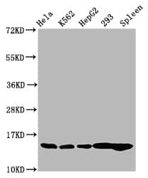 HIST1H2BN Antibody