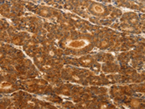 CD144 / CDH5 / VE Cadherin Antibody