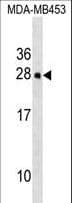 Polyclonal Rabbit anti-Mouse HOXC5 Antibody (aa140-167, WB)