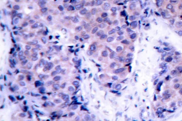 PDPK1 / PDK1 Antibody (Lys235)