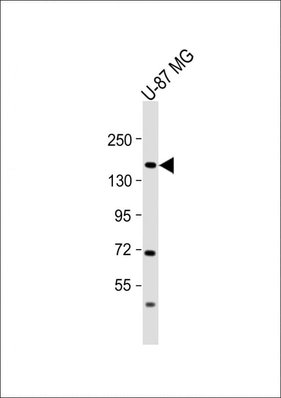 ADAMTS20 Antibody (Internal)