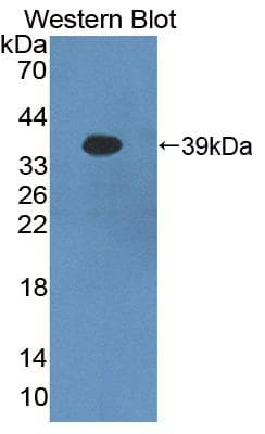 PCDHB16 Antibody (aa35-347, PE)