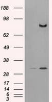 IHC-plus™ DPP4 / CD26 Antibody (clone 11D7)