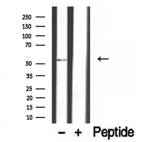 Polyclonal Rabbit anti-Human FAF2 / ETEA Antibody (IHC, WB)