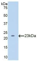 Mouse LCAT Protein (Native His, N-Terminal)