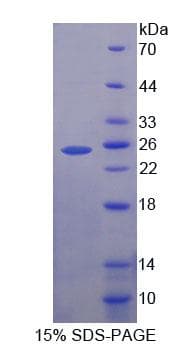 Human EZH2 Protein (Recombinant His-T7)