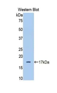 CFB / Complement Factor B Antibody (aa477-600)