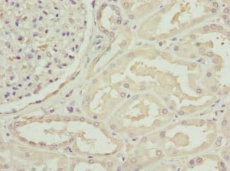 Polyclonal Rabbit anti-Human C1GALT1C1 Antibody (IHC, IF, WB)