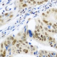 IRF6 Antibody