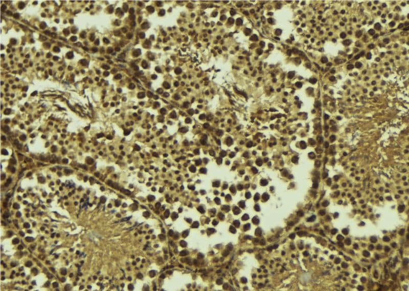 TAF7L Antibody