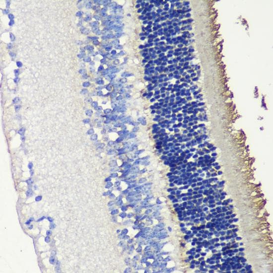 SAG / Arrestin Antibody