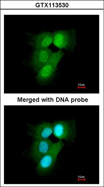 Polyclonal Rabbit anti-Human PSMA6 Antibody (aa57-274, IHC, WB)