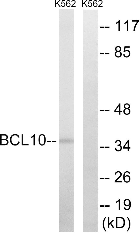 PathPlus™ BCL10 / BCL-10 Antibody (aa111-160)