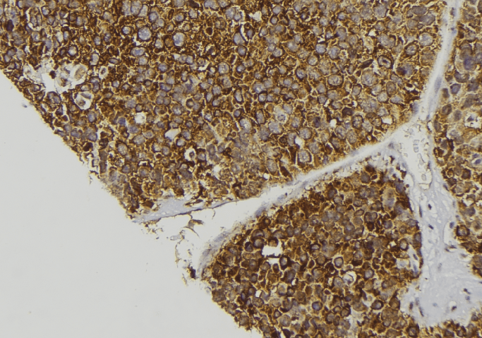 F13A1 / Factor XIIIa Antibody