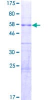 Human FAM60A Protein (Recombinant GST)