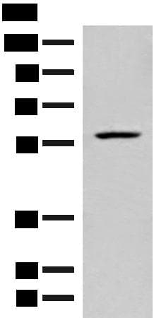 FKTN / Fukutin Antibody