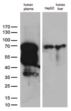 F2 / Prothrombin / Thrombin Antibody (aa44-622, clone OTI5G10)