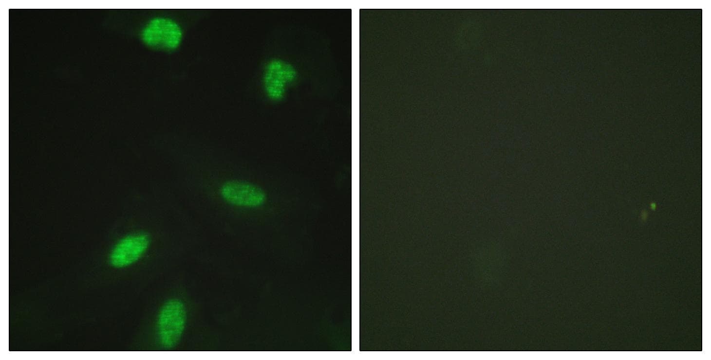 RB1 / Retinoblastoma / RB Antibody (phospho-Thr821)