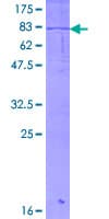 Human ACVR1C / ALK7 Protein (Recombinant GST)