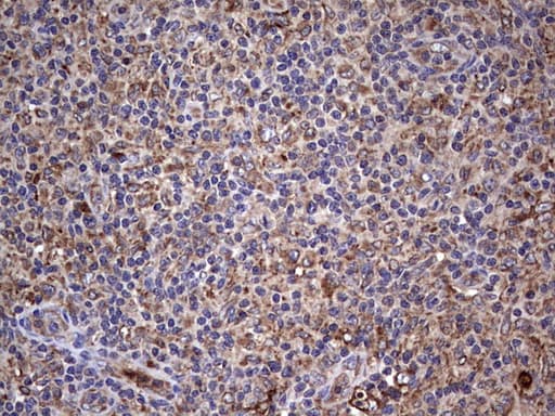 BFSP1 / Filensin Antibody (aa405-665, clone OTI3H6)