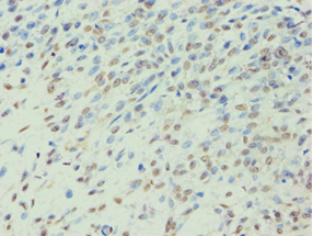 Polyclonal Rabbit anti-Human BCKDK Antibody (aa153-412, IHC, WB)