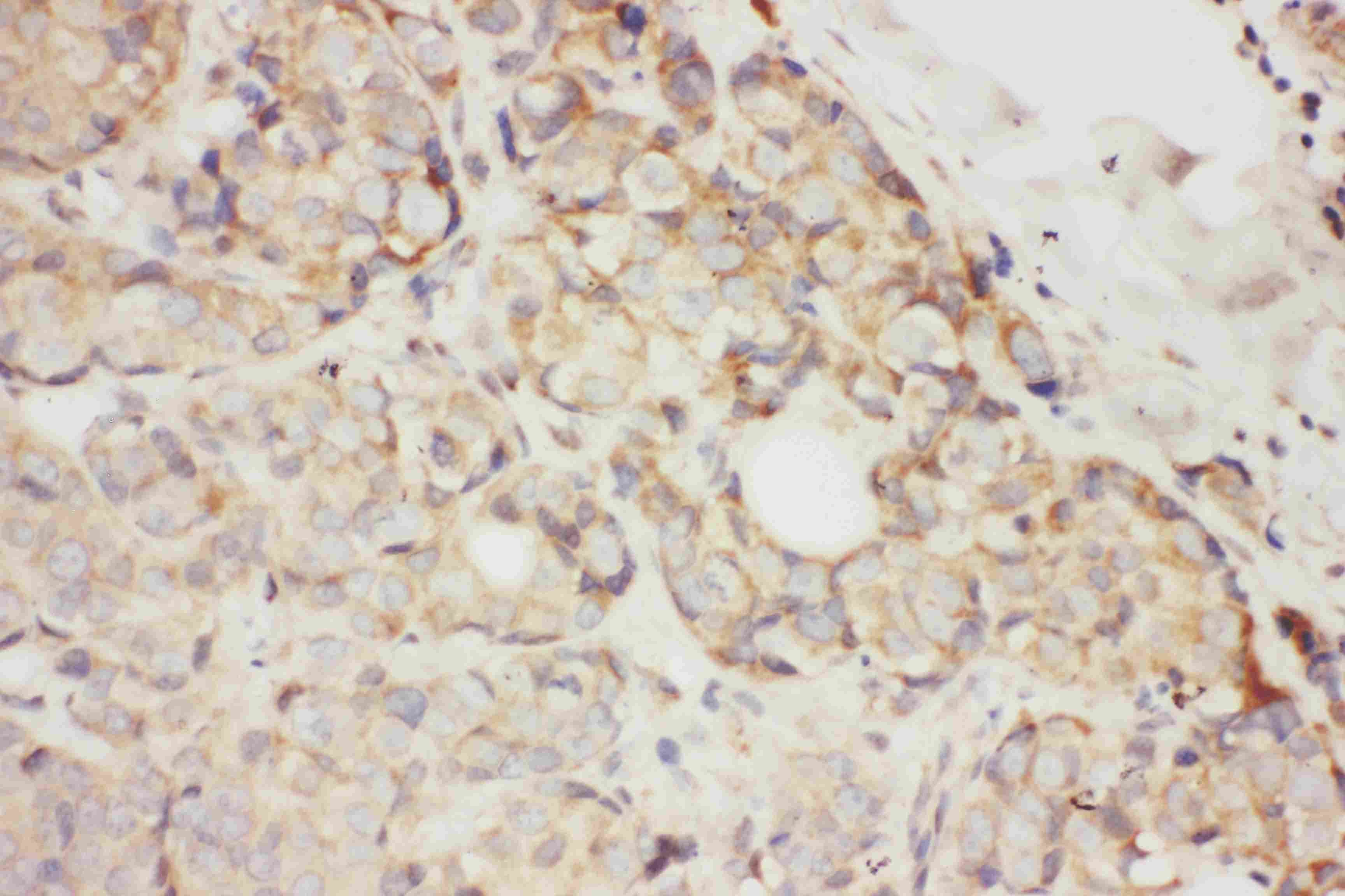 KITLG / SCF Antibody (aa26-44)