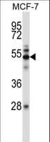 Polyclonal Rabbit anti-Mouse MAP3K7 / TAK1 Antibody (aa131-160, IHC, WB)