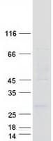 Human LAPTM4A Protein (Recombinant Myc-DDK (Flag))