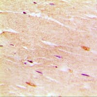 ATP2A1 / SERCA1 Antibody (Internal)