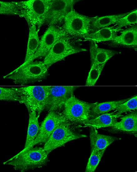 HMG-CoA Reductase / HMGCR Antibody