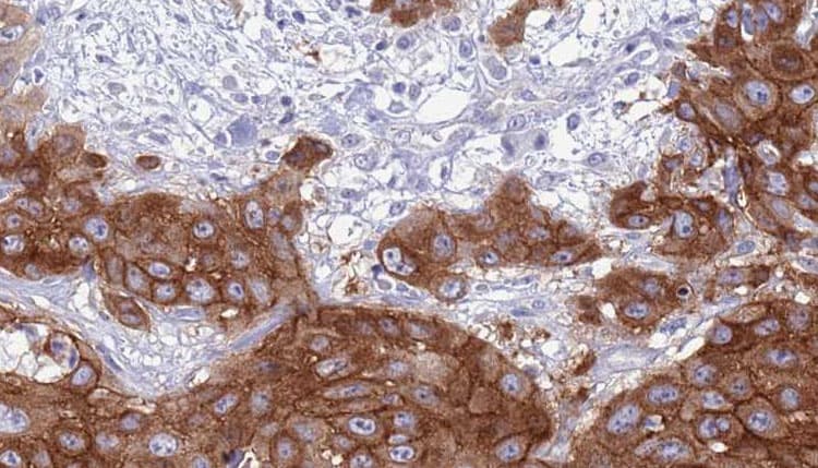ALK3 / BMPR1A Antibody