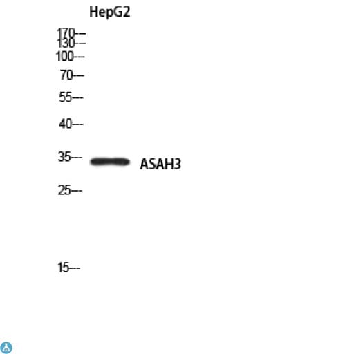 ACER1 / ASAH3 Antibody