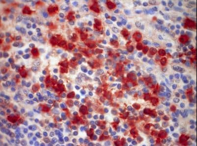 Monoclonal Mouse anti-Human S100A9 / MRP14 Antibody (clone S36-48, IHC)