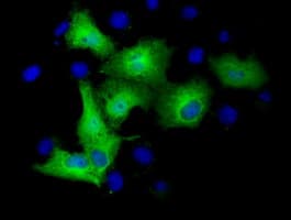 TUBA3E / Tubulin Alpha 3E Antibody (clone OTI2B4)