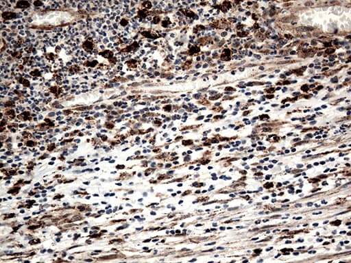 CTSL / Cathepsin L Antibody (aa114-333, clone OTI1C7, Carrier-free)