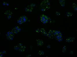 TLDC1 / KIAA1609 Antibody (clone OTI7E4)