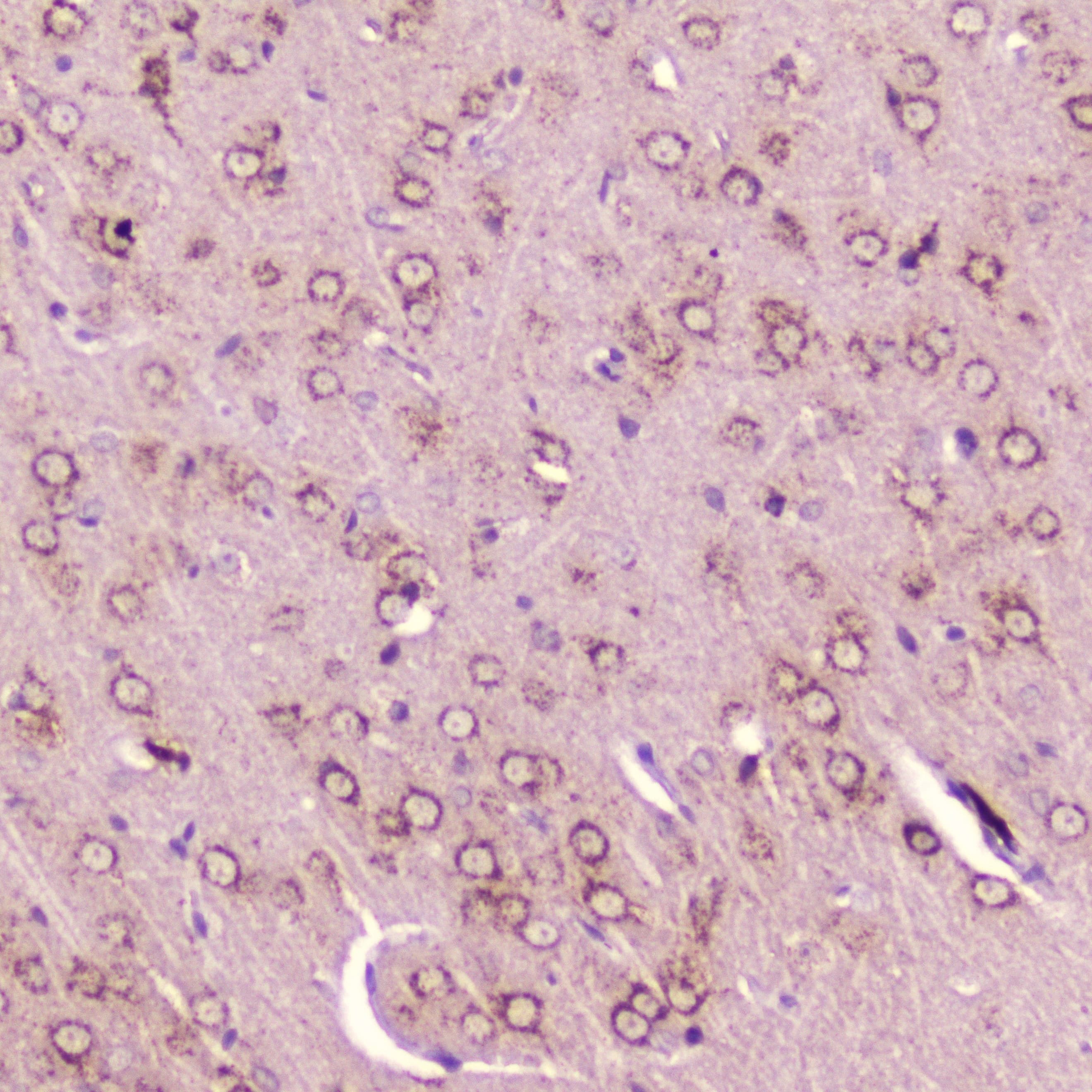 Polyclonal Rabbit anti-Mouse CALCA Antibody (IHC)