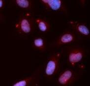 CHEK1 / CHK1 Antibody (phospho-Ser280)