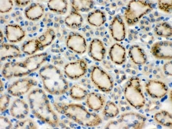 Polyclonal Rabbit anti-Mouse MMP9 / Gelatinase B Antibody (IHC, WB)