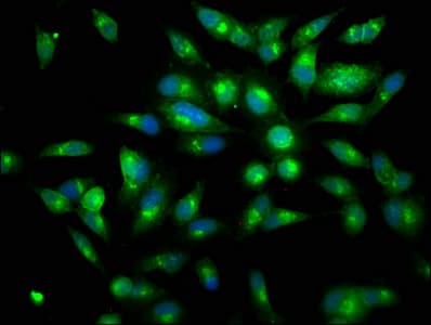 LF / LTF / Lactoferrin Antibody