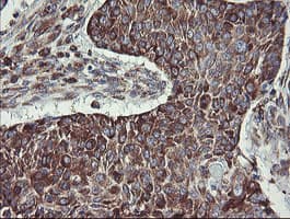TPD52L3 Antibody (clone OTI8C12)