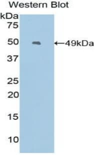 EREG / Epiregulin Antibody (aa30-169, Cy3)