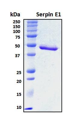 Mouse SERPINE1 / PAI-1 Protein (Recombinant His, N-Terminal)