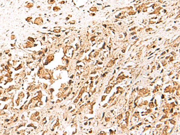 TRF1 / TERF1 Antibody