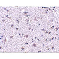 CDNF / ARMETL1 Antibody