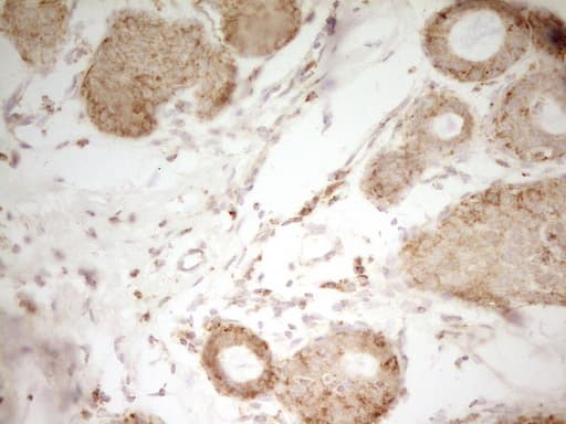 Monoclonal Mouse anti-Human MRRF Antibody (clone OTI1D5, aa56-262, IHC, WB)